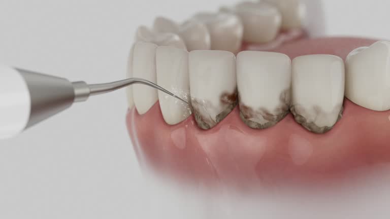 Reliable Dental Implants contractor in Hooker County County, NE by Dentist Open Now
